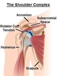Is shoulder impingement causing my shoulder to hurt?